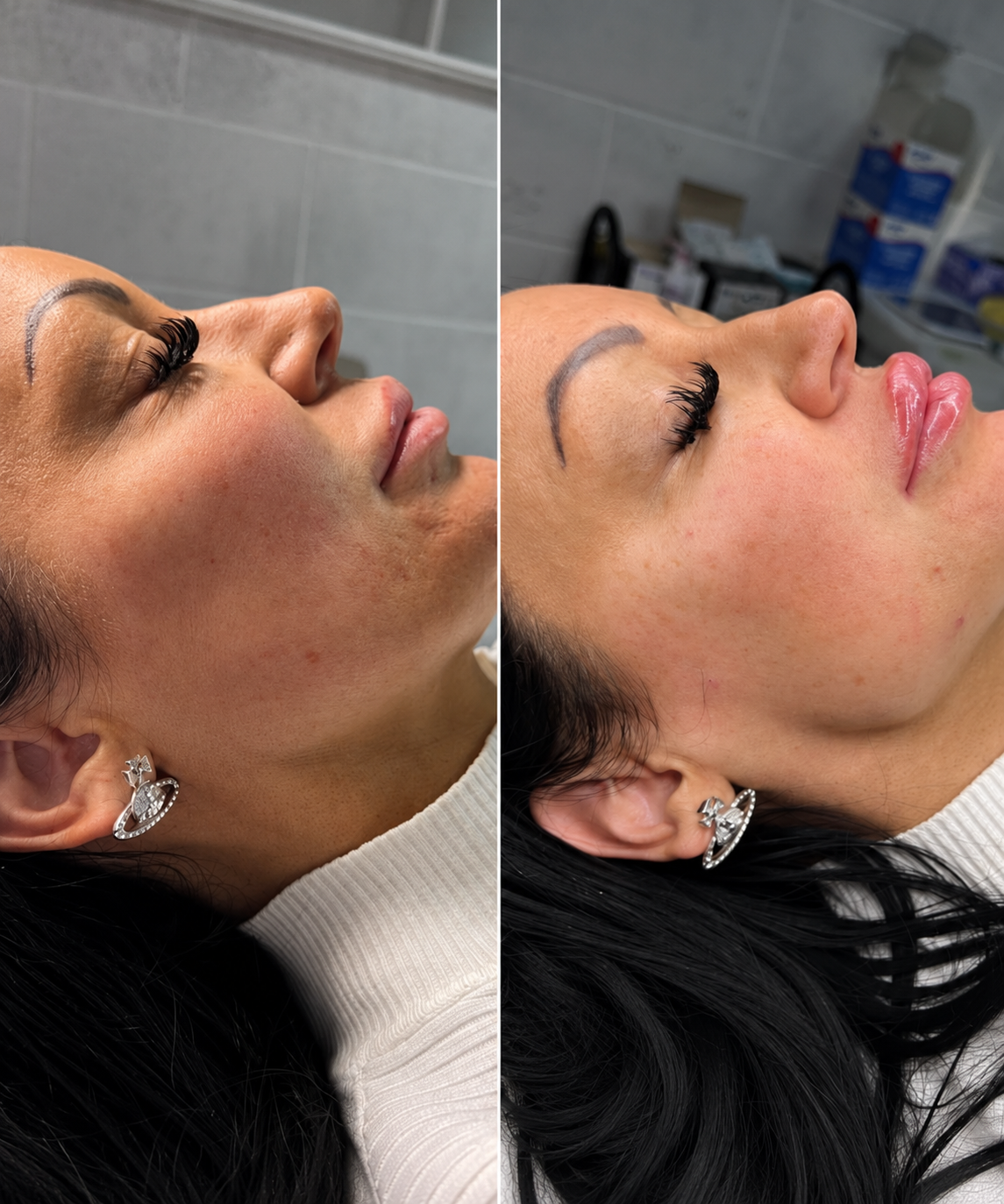 PATHWAY to Aesthetics Course